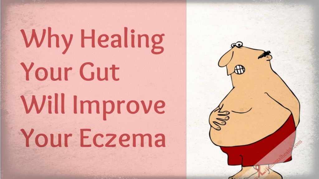 Eczema Treatment by way of Healing Leaky Gut - For people dealing with leaky gut and seeking eczema treatment, it is best to choose the right type of food. Read on to find out more.