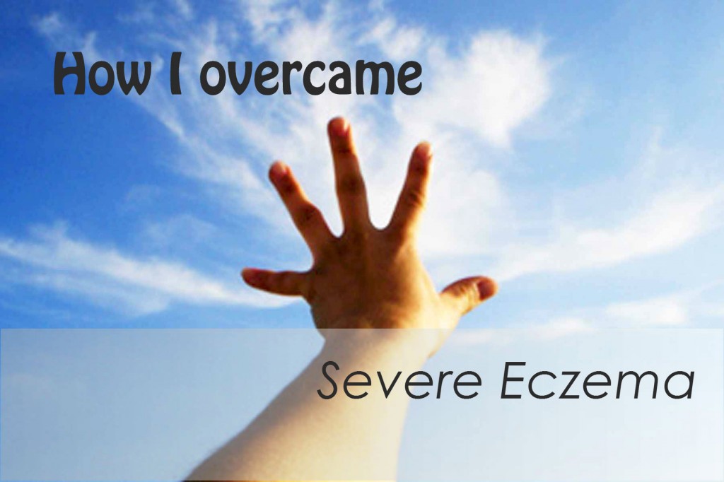How to Treat Severe Eczema? If you have severe eczema, don’t lose hope. With a solid eczema treatment program, which involves a multifaceted approach that includes medical treatments and lifestyle modifications, you can find relief and restore your skin’s texture and health.