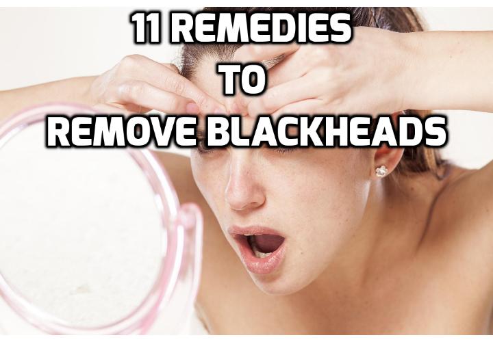 11 Simple Remedies to Get Rid of Blackheads - Common and annoying, blackheads occur when your pores become clogged with excess oil and dead skin cells. Read on to find out about the 11 simple remedies to get rid of blackheads naturally.