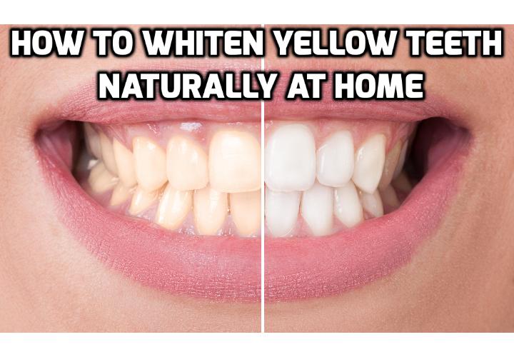 3 Teeth Whitening Tips to Whiten Yellow Teeth Naturally - Whiter teeth (like thick, shiny hair) are something that many people in our cosmetically driven world desire today. Here are 3 teeth whitening tips you can use to whiten your yellow teeth naturally at home.