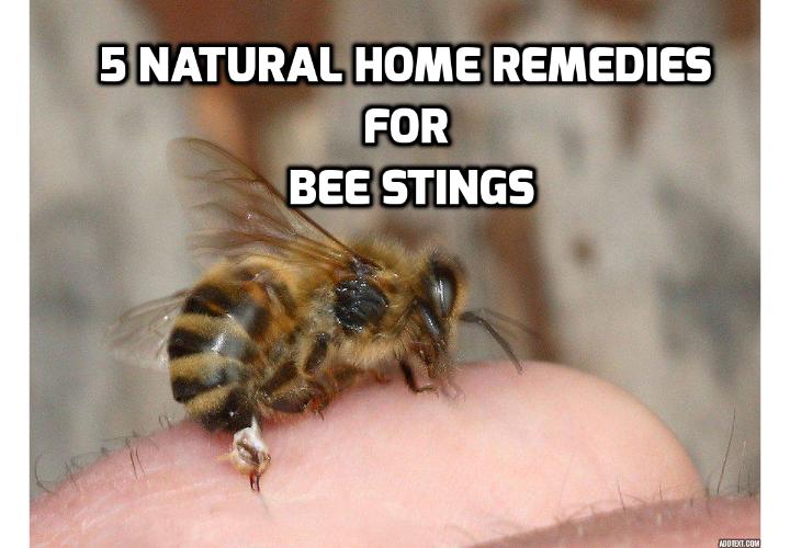 Here are 5 Effective Home Remedies for Bee Stings - If you are thinking of what can you do after being stung by a bee, read on here to find out about the 5 effective home remedies for bee stings you can use to help ease the discomfort.