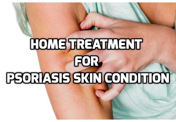 Which are really the Best Psoriasis Home Remedies? Psoriasis home remedies are the lowest cost treatments for dealing with psoriasis. More often than not, they are all-natural cures and won’t harm you with harsh side-effects. Read on here to find out more.