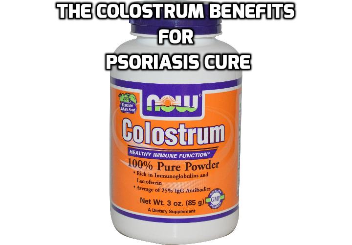 What are the Colostrum Benefits that really Help Cure Psoriasis? If you are looking for natural cures or some way to control the outbreaks and the symptoms associated psoriasis, read on to learn about the colostrum benefits in helping you to achieve this.