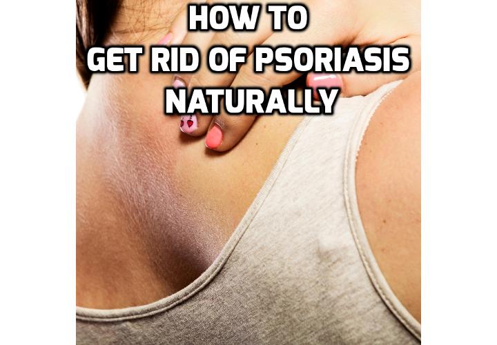 How Best to Really Cure Psoriasis Naturally? There are actually some things you can start doing for yourself that might help to cure psoriasis naturally and slow down the onset of another outbreak. Read on here to find out more.
