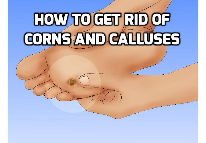 How to Use Bread and Lemon to Get Rid of Corns and Calluses on Feet, Toes, Hands? If you decide you don’t want that little tough patch of skin any longer, these 2 remedies here to get rid of corns and calluses are a simple and easy way to get it to go away.