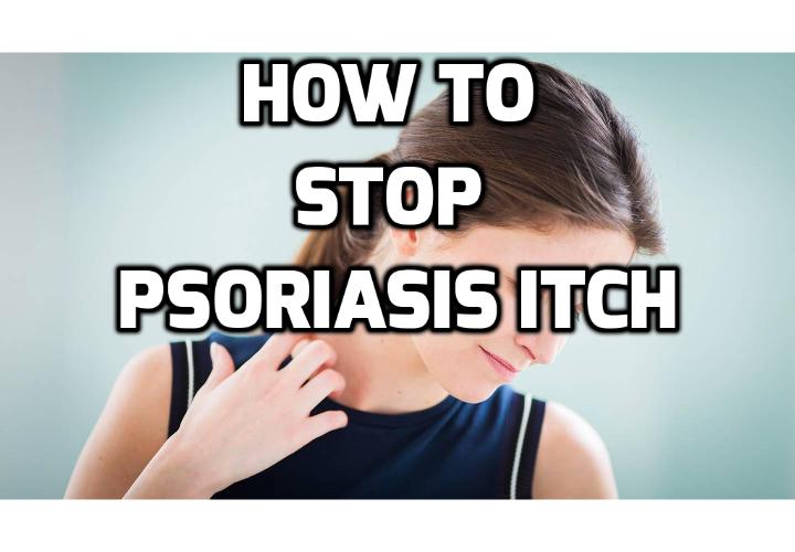 How Best to Really Prevent Psoriasis Outbreaks Absolutely? Psoriasis is an ailment no one likes to deal with. There are no cures but there are ways to prevent psoriasis outbreaks and deal with symptoms. Read on to find out more.