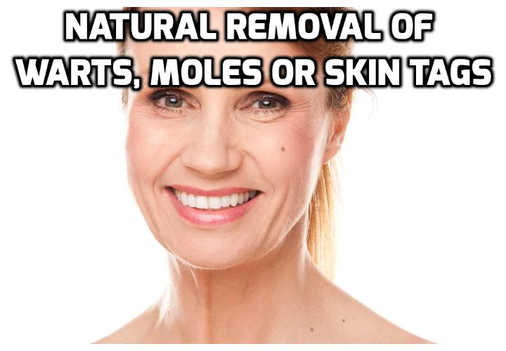 How to Restore Self-Confidence with Natural Wart Removal? If you are a teenager and suffer from acne problems in a rather severe way, you know how this may lower your self-confidence. The same applies if you have a wart, mole or skin tag in parts of your body that are visible. Read on here to find out how you can naturally remove your warts, moles or skin tags easily without surgery.