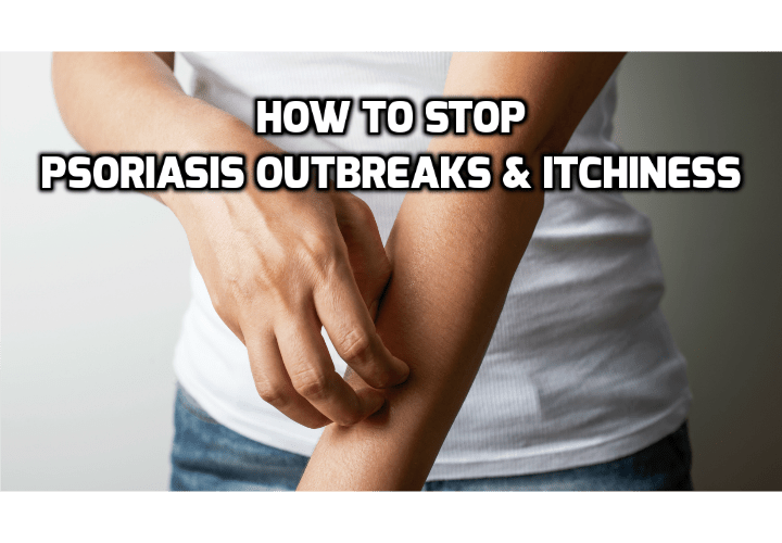 What is Psoriasis & How Best to Quickly Prevent Breakouts? In order to fully deal with the symptoms of psoriasis and prevent breakouts you are required to understand what psoriasis is, and how it affects your skin.