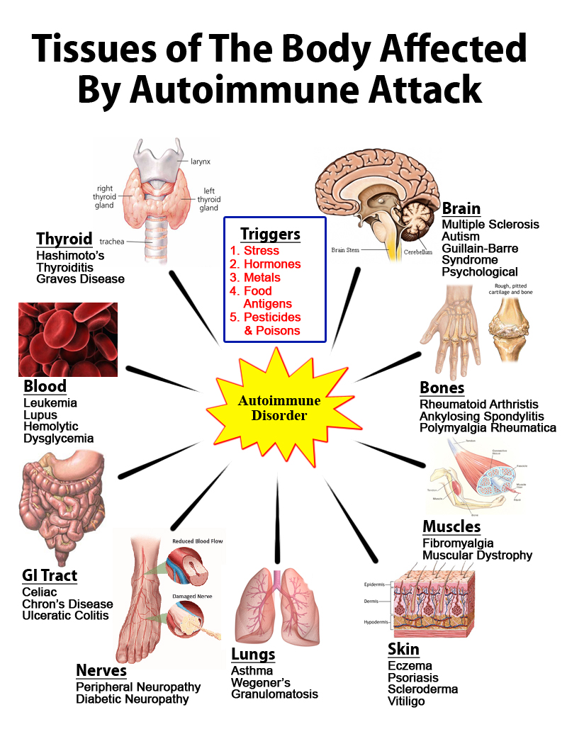 How Best to Really Avoid Autoimmune Diseases Immediately? How do Autoimmune Diseases Happen and How to Avoid Autoimmune Diseases? Read on to find out more.