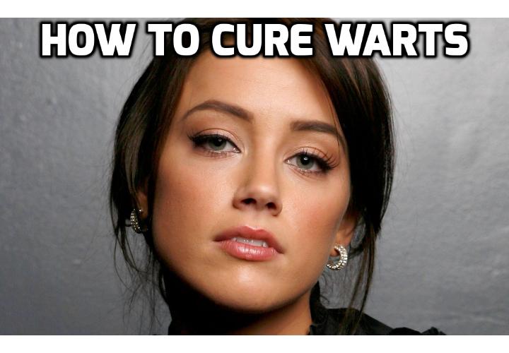 Why You Get Warts & How Best to Really Remove Warts Easily? You can get warts by being infected by the human papilloma virus or HPV. A wart is in reality a non-cancerous growth caused by an infection by this type of virus. Read on here to find out how you can remove warts fast.