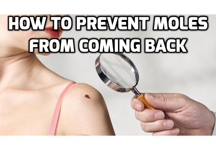 How to Prevent Skin Moles from Coming Back After Removal? There are a few things you can do to try to prevent skin moles from coming back after removal. Read on here to find out more.